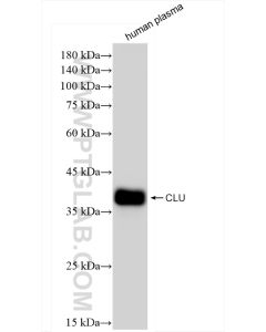 Clusterin Recombinant monoclonal antibody proteintech 84067-4-RR
