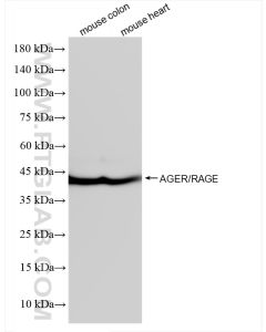 AGER/RAGE Recombinant monoclonal antibody proteintech 83759-5-RR