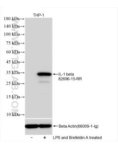 IL-1 beta Recombinant monoclonal antibody proteintech 82696-15-RR