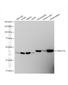 KIAA1715 Recombinant monoclonal antibody proteintech 83418-5-RR