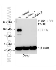 BCL6 Recombinant monoclonal antibody proteintech 81754-1-RR