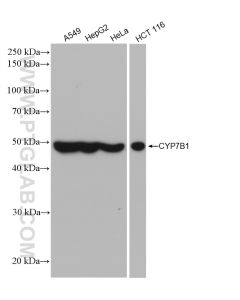 CYP7B1 Recombinant monoclonal antibody proteintech 82927-1-RR
