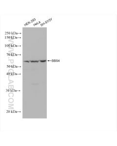 BBS4 Recombinant monoclonal antibody proteintech 82961-1-RR