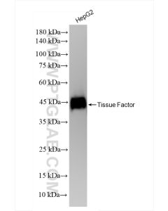 Tissue Factor/CD142 Recombinant monoclonal antibody proteintech 83776-4-RR