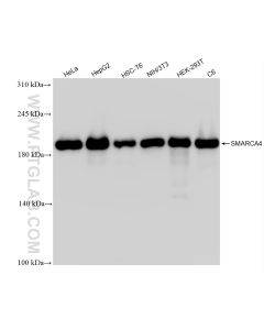 SMARCA4/BRG1 Recombinant monoclonal antibody proteintech 83310-2-RR