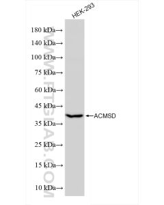 ACMSD Recombinant monoclonal antibody proteintech 84100-3-RR