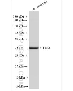 PDK4 Recombinant monoclonal antibody proteintech 83583-1-RR