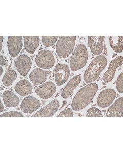 IQUB Recombinant monoclonal antibody proteintech 83847-5-RR