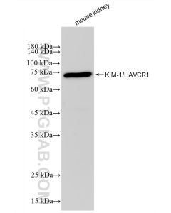 KIM-1/HAVCR1 Recombinant monoclonal antibody proteintech 83221-2-RR