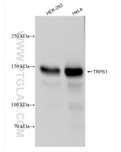 TRPS1 Recombinant monoclonal antibody proteintech 83062-4-RR