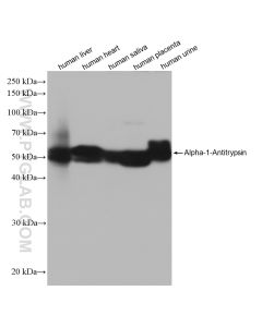Alpha-1-Antitrypsin Recombinant monoclonal antibody proteintech 82918-1-RR