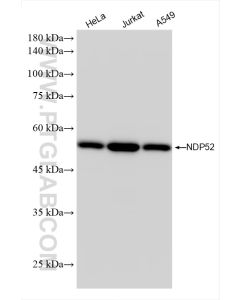 NDP52 Recombinant monoclonal antibody proteintech 86167-1-RR
