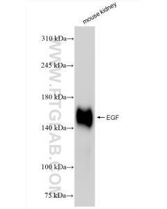 EGF Recombinant monoclonal antibody proteintech 84601-1-RR