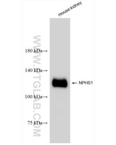 Nephrin Recombinant monoclonal antibody proteintech 85845-1-RR