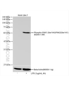 Phospho-PAK1 (Ser144)/PAK2 (Ser141) Recombinant monoclonal antibody proteintech 85044-1-RR