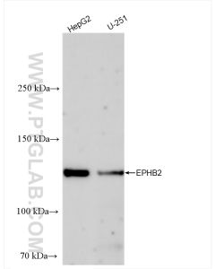 EPHB2 Recombinant monoclonal antibody proteintech 83277-1-RR