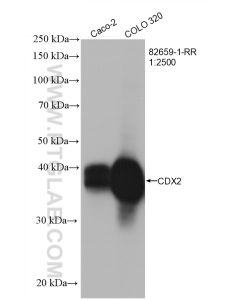 CDX2 Recombinant monoclonal antibody proteintech 82659-1-RR