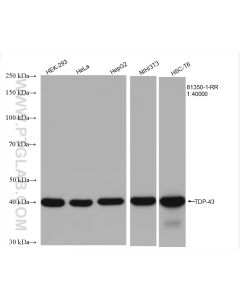 TDP-43 (C-terminal) Recombinant monoclonal antibody proteintech 81350-1-RR