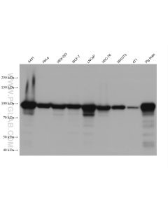 Beta Catenin Recombinant monoclonal antibody proteintech 80488-1-RR