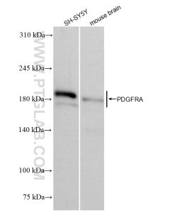 PDGFR alpha/CD140a Recombinant monoclonal antibody proteintech 84383-2-RR