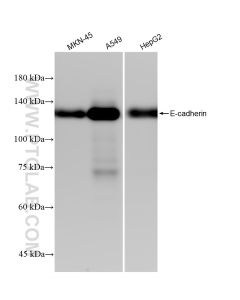 E-cadherin Recombinant monoclonal antibody proteintech 80541-9-RR