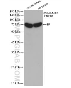 Transferrin Recombinant monoclonal antibody proteintech 81676-1-RR