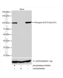 Phospho-STAT3 (Ser727) Recombinant monoclonal antibody proteintech 80199-2-RR