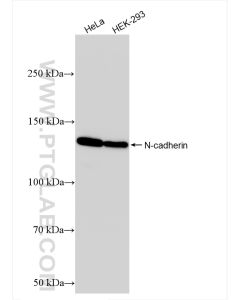 N-cadherin Recombinant monoclonal antibody proteintech 82968-1-RR