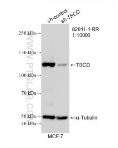 TBCD Recombinant monoclonal antibody proteintech 82911-1-RR