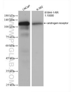 androgen receptor Recombinant monoclonal antibody proteintech 81844-1-RR