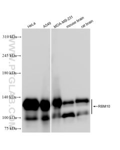 RBM10 Recombinant monoclonal antibody proteintech 84104-4-RR