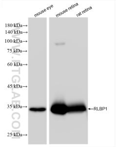 RLBP1 Recombinant monoclonal antibody proteintech 85697-1-RR