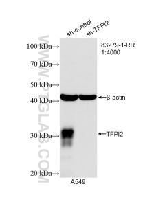 TFPI2 Recombinant monoclonal antibody proteintech 83279-1-RR