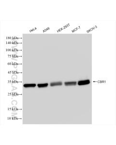 CBR1 Recombinant monoclonal antibody proteintech 83736-4-RR
