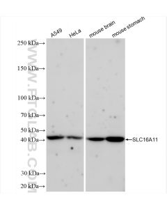 SLC16A11 Recombinant monoclonal antibody proteintech 83239-5-RR