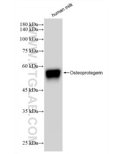 Osteoprotegerin/TNFRSF11B Recombinant monoclonal antibody proteintech 83506-1-RR