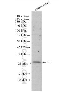 C-Reactive Protein/CRP Recombinant monoclonal antibody proteintech 83711-1-RR
