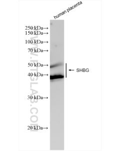 SHBG Recombinant monoclonal antibody proteintech 83096-1-RR
