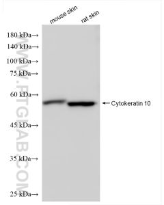Cytokeratin 10 Recombinant monoclonal antibody proteintech 86324-1-RR
