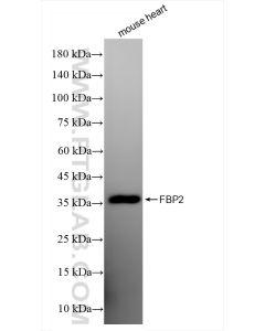 FBP2 Recombinant monoclonal antibody proteintech 83910-5-RR