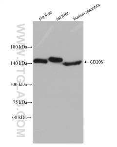 CD206 Recombinant monoclonal antibody proteintech 81525-1-RR