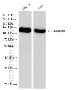 E-cadherin Recombinant monoclonal antibody proteintech 84646-3-RR