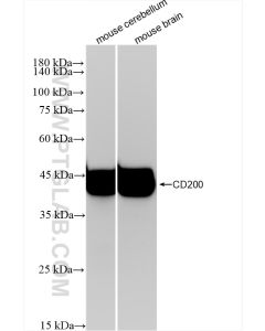 CD200 Recombinant monoclonal antibody proteintech 83437-5-RR