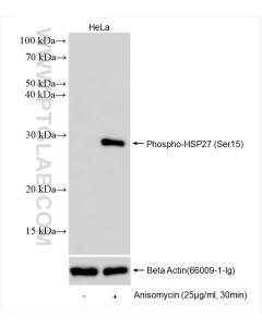 Phospho-HSP27 (Ser15) Recombinant monoclonal antibody proteintech 83332-3-RR