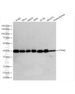 PTPN2 Recombinant monoclonal antibody proteintech 85915-1-RR