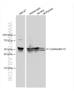 Cytokeratin 13 Recombinant monoclonal antibody proteintech 83058-1-RR