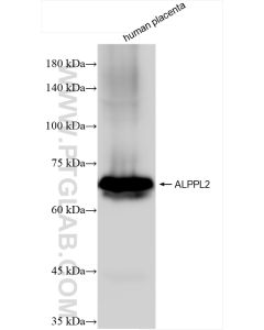 ALPPL2 Recombinant monoclonal antibody proteintech 84813-1-RR