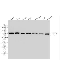 NCBP1/CBP80 Recombinant monoclonal antibody proteintech 83212-4-RR