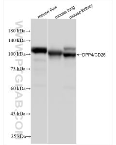 DPP4/CD26 Recombinant monoclonal antibody proteintech 85159-3-RR