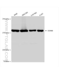 DDX60 Recombinant monoclonal antibody proteintech 82969-1-RR